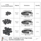 O-ring Replacement Kit With 36 Durable Buna-n Sizes For Dental Implants. Fixed Price $16.69.